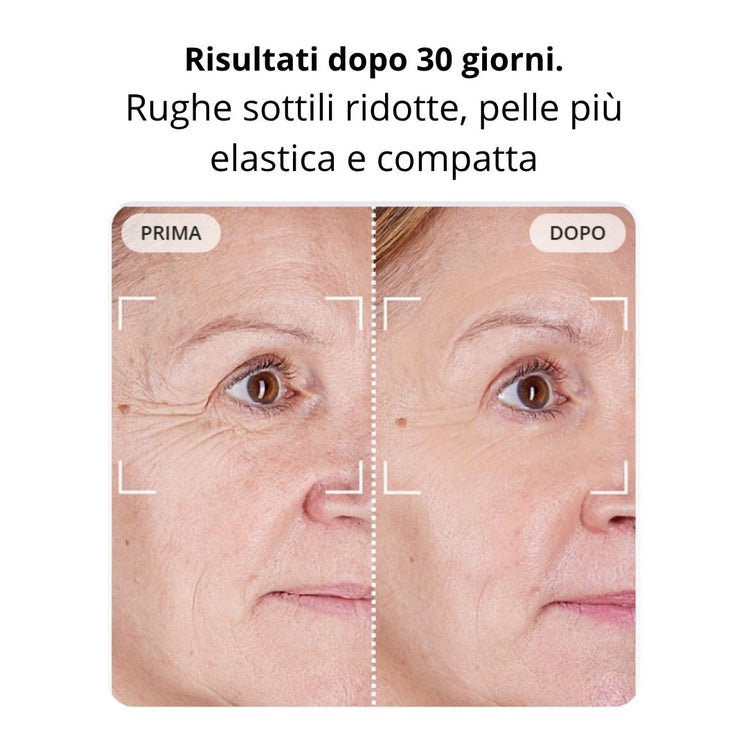 MAGICWAND™ - seuniQueRugheAntietàcontorno occhiZampe di gallinarimpolpanteringiovanire