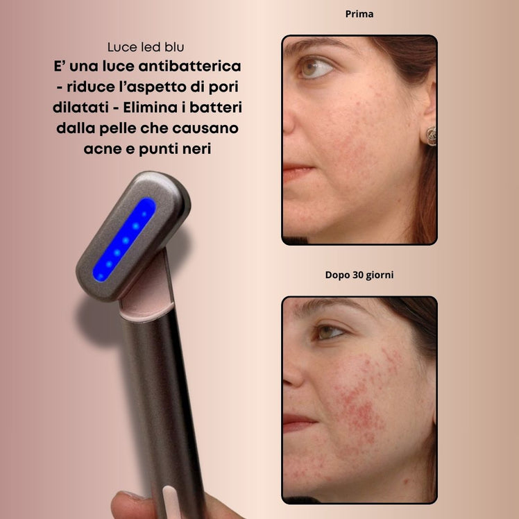 MAGICWAND™ - seuniQueRugheAntietàcontorno occhiZampe di gallinarimpolpanteringiovanire